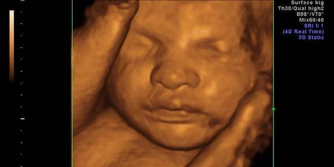 Υπερηχογράφημα - Μαιευτικοί υπέρηχοι στην εγκυμοσύνη. Τεστ Εμβρυϊκής Πρωτεΐνης, αμνιοπαρακέντηση, υπερηχογράφημα ανάπτυξης