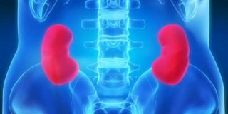 Κωλικός Νεφρού (ισχυρός ανθρώπινος πόνος). Πόνος στα νεφρά. Η κυριότερη αιτία η λιθίαση του ουροποιητικού συστήματος.