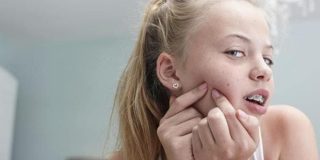 Έφηβη στον καθρέπτη κοιτάζει την ακμή και τα σπυράκια της - Αιτίες, συμπτώματα, θεραπεία, φάρμακα και πρόληψη