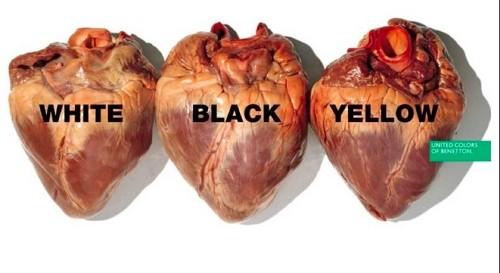 antiratsistika-minimata-poster-3