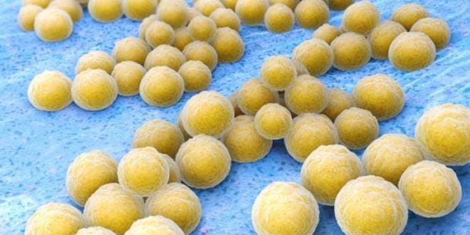 Σταφυλόκοκκος - Λοίμωξη από σταφυλόκοκκο. Πώς μεταδίδεται και πώς θεραπεύεται